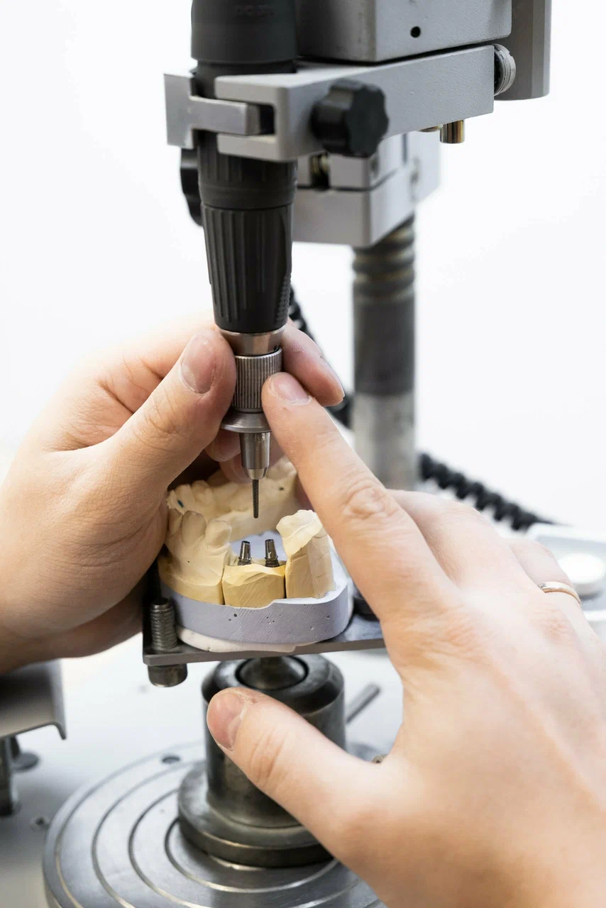 Формирователь десны — имплантация зубов в клинике EK Dental, Екатеринбург