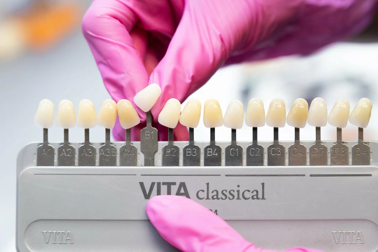 Коронка и контроль — имплантация зубов в клинике EK Dental, Екатеринбург